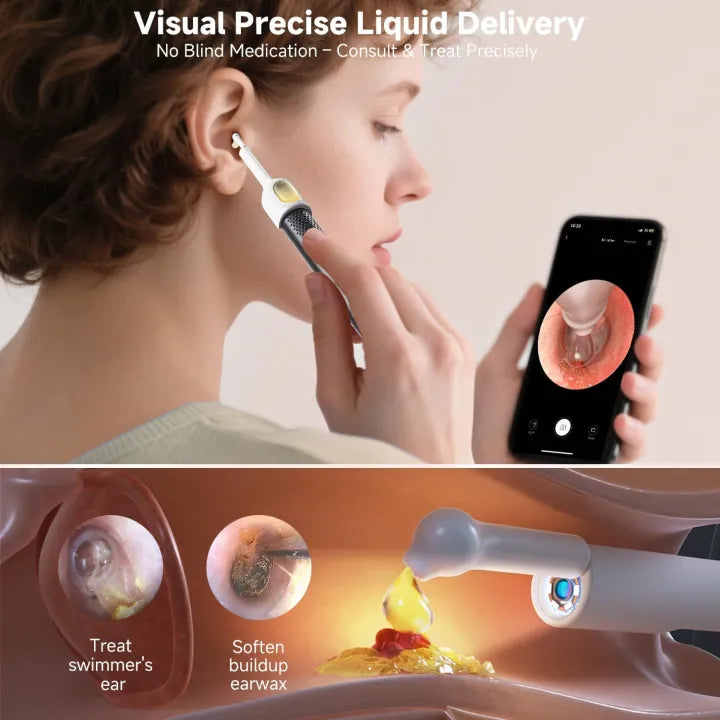 Smart Visual Ear Wax Removal Tool – Wireless Otoscope Camera Kit