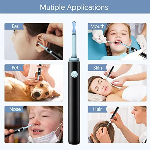 Smart Visual Ear Wax Removal Tool – Wireless Otoscope Camera Kit